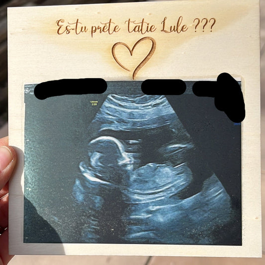carte annonce en bois echographie